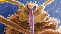 In Bedbugs, Scientists Don’t See a Model of Evolution