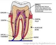 How Root Canals Could Spark Autoimmune Diseases