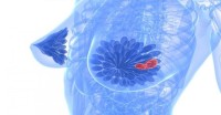 Surprising Causes Of Breast Cancer