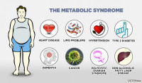 Metabolic Syndrome: Why this Epidemic is Sweeping America