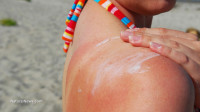 Four things you need to understand about your sun exposure