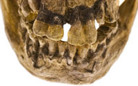 Tooth Study Takes Bite Out of Evolution