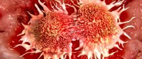 Study Claims to Have Found Cancer’s Achilles Heel