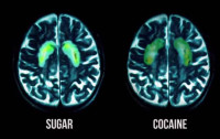 Sugar Addiction Like a Cocaine Habit