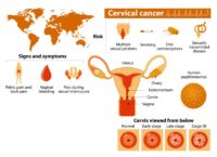 Most Women Miss These 3 Early Signs Of Cervical Cancer!