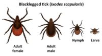 How to Keep Ticks off of You, and Get Rid of Them if Needed