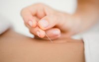 Acupuncture: Thousand Year Old Therapy Has Tremendous Modern Day Success