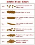 How Perfect Is Your Poop?