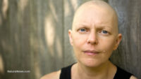 Chemotherapy patients’ quality of life suffers long after treatment