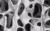 Improved Steel Copies Bone Microstructure