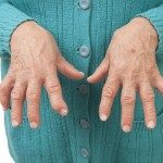 Rheumatoid arthritis symptoms reduced by taking quercetin