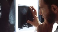 Consequences of False-Positive Mammogram Results