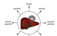 Natural and Non-toxic Options for Treating Hepatitis C or Liver Inflammation