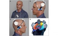Photobiomodulation Technology is Healing Neurological Diseases