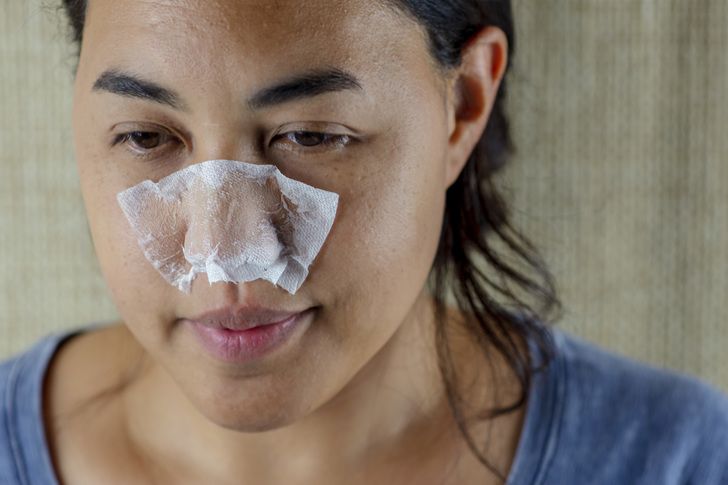 5 Minute DIY Pore Strips To Remove Blackheads