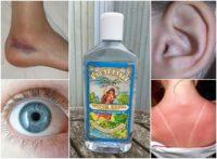 Witch Hazel: 14 Surprising Uses For This Powerful Little Bottle