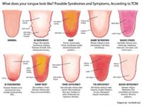 The Appearance of Your Tongue Says a Lot About Your Health