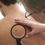 Low levels of coenzyme Q10 linked to increased risk of melanoma metastasis