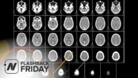 Flashback Friday: Preventing Brain Loss with B Vitamins?
