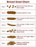 What Should Your Poop Look Like?