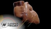 Flashback Friday: Dark Chocolate and Artery Function