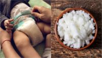 16 Best Ways To Soothe A Diaper Rash