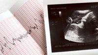 The “Fetal Heartbeat” Isn’t the Issue