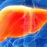 Fix your liver: Nonalcoholic fatty liver disease is surging in the U.S.
