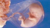 Recapitulation Theory: How Embryology Does Not Prove Evolution