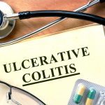 Eliminate ulcerative colitis naturally